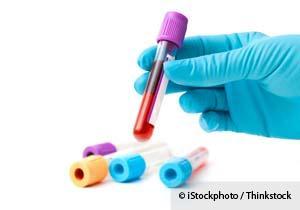 krevní testy